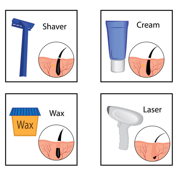 Методи видалення волосся та його результат Векторні ілюстрації
 - Вектор, зображення