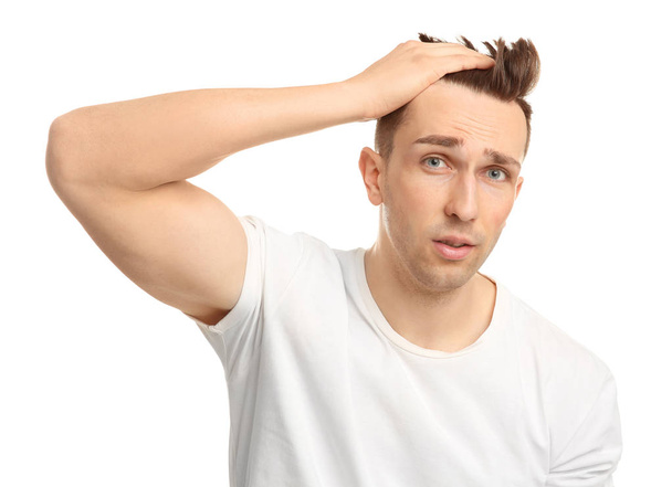 Young man with hair loss problem on white background - Foto, Imagem
