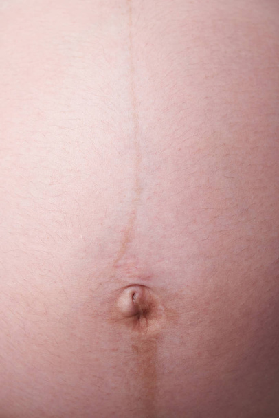 lähikuva navasta raskaana oleva nainen
 - Valokuva, kuva