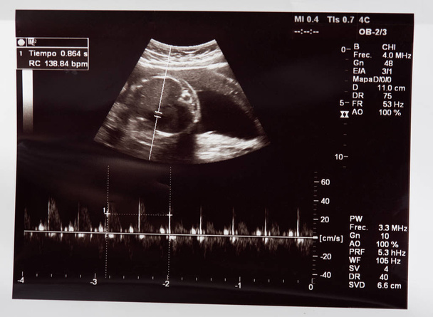 Battito cardiaco del bambino nella pancia della donna incinta
 - Foto, immagini
