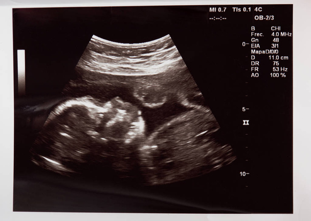 Babykopf auf Ultraschalluntersuchung - Foto, Bild