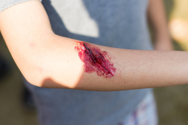La herida falsa en el brazo para el niño Asia, Viste la herida efecto especial, enfoque selectivo
 - Foto, Imagen