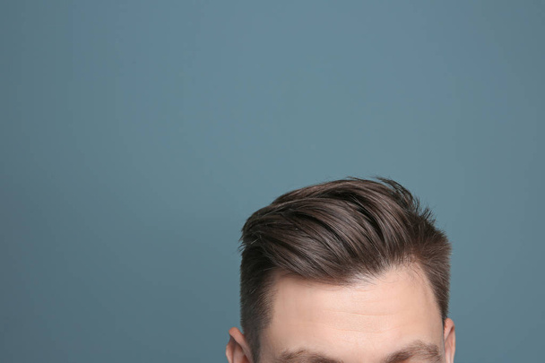 Mladý muž s problémem vypadávání vlasů na barevném pozadí - Fotografie, Obrázek