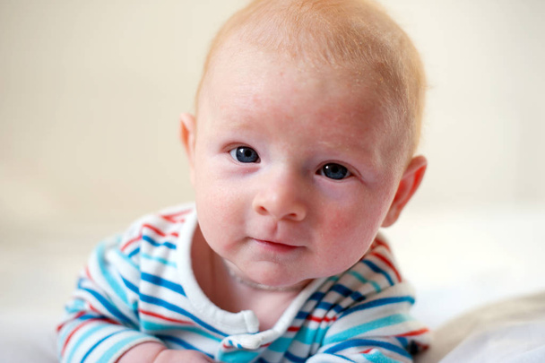 Allergies, atopic dermatitis on the face of a baby - Fotó, kép