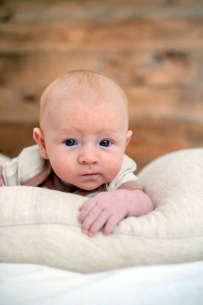 Allergies, atopic dermatitis on the face of a baby - Photo, Image