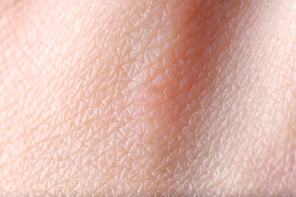 Texture of skin, closeup - Photo, Image