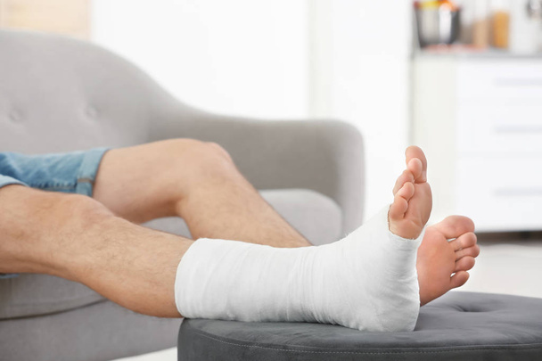 Young man with broken leg in cast sitting on sofa at home - Foto, afbeelding