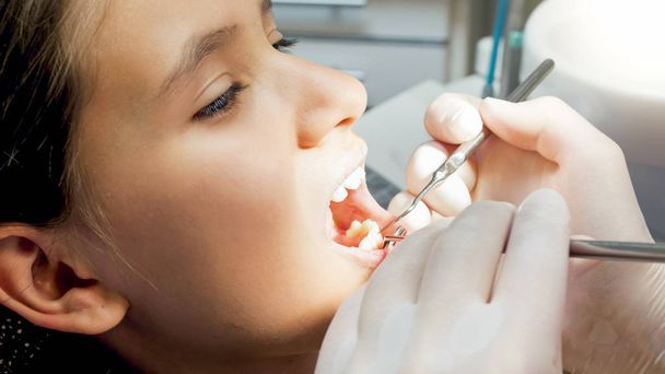Nahaufnahme eines Zahnarztes, der die Zähne von Mädchen mit Spiegel und speziellen Instrumenten untersucht - Foto, Bild