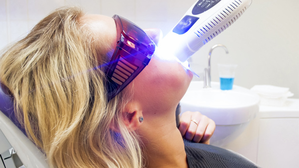 Close-up beeld van speciale UV-lamp tijdens tanden whitening procedure - Foto, afbeelding