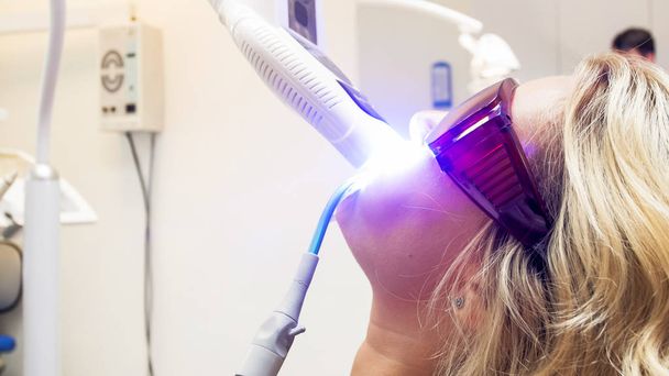 Closeup portret van de jonge vrouw whitening tanden met speciale UV-lamp in het kantoor tandarts - Foto, afbeelding