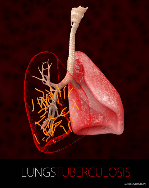 Bacterie Mycobacterium tuberculosis, de verwekker van tuberculose, 3d illustratie - Foto, afbeelding