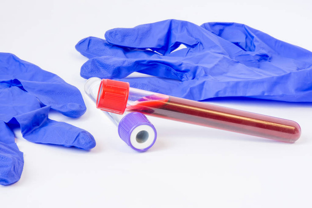 Two laboratory test tubes with blood, plasma or other biological fluid samples are on table near protective latex gloves on white background. Concept photo for clinical laboratory tests to determine  - Photo, image