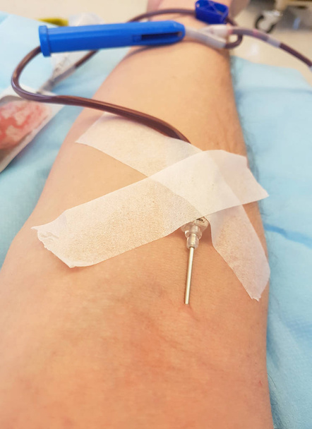 brazo de un voluntario durante la donación de sangre
 - Foto, Imagen