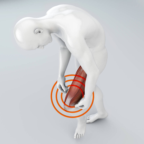 Разрыв мышц, мышцы бедра выше колена. Боль в ноге и связках. Человеческое тело, 3D рендеринг
 - Фото, изображение