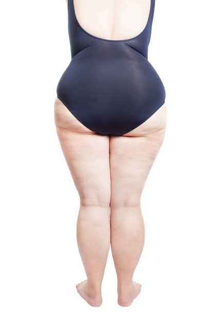 dicke Frau im Badeanzug mit dem Rücken gewendet (übergewichtig, fettleibig) - Foto, Bild