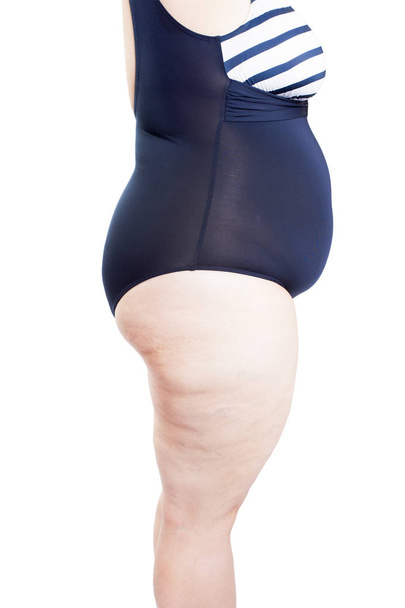 mujer gorda en traje de baño se volvió hacia los lados (sobrepeso, obesidad
) - Foto, Imagen