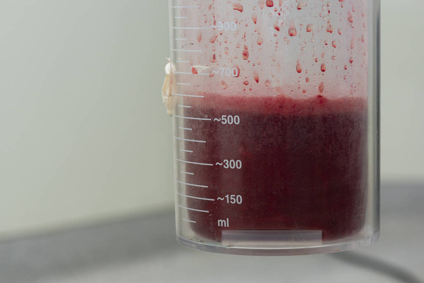 Dużo krwi w kontenerze ssania - Zdjęcie, obraz
