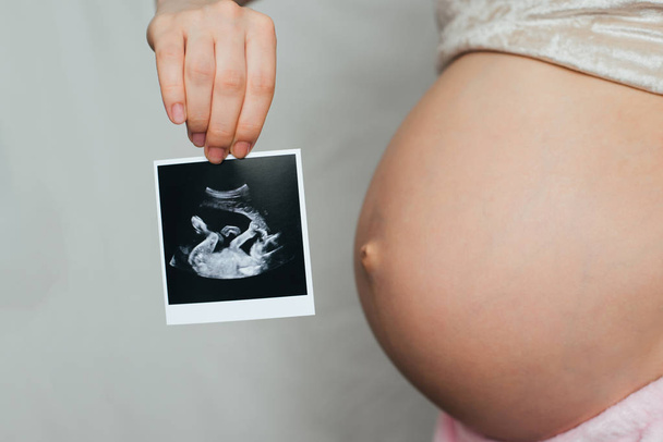 echografie foto in de handen van een zwanger meisje - Foto, afbeelding