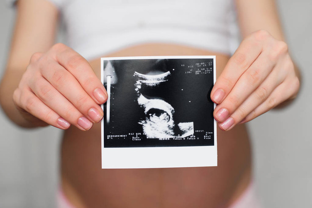 photo of a pregnant ultrasound in the hands of a pregnant girl - Foto, imagen