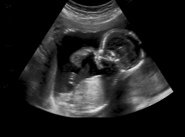 Ultrasound of baby in mother's womb. - Photo, Image