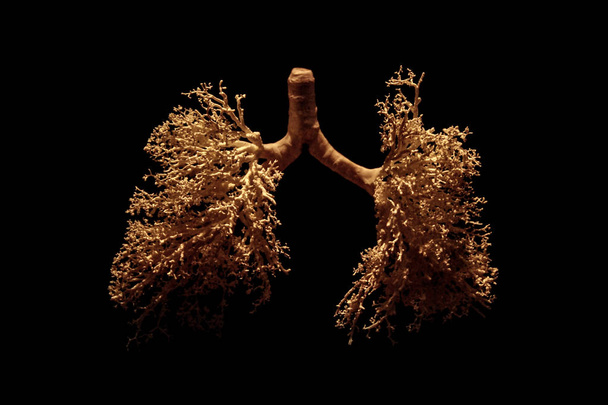 New York City, Verenigde Staten - 11 augustus 2012: Gunther von Hagens Body Worlds tentoonstelling. Een menselijke longen geïsoleerd op zwarte achtergrond - Foto, afbeelding