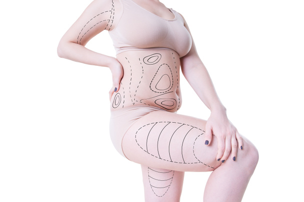 Liposuction, fat and cellulite removal concept, overweight female body with painted lines and arrows - Zdjęcie, obraz