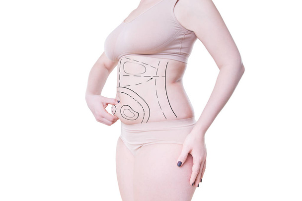 Liposuction, fat and cellulite removal concept, overweight female body with painted lines and arrows - Foto, imagen