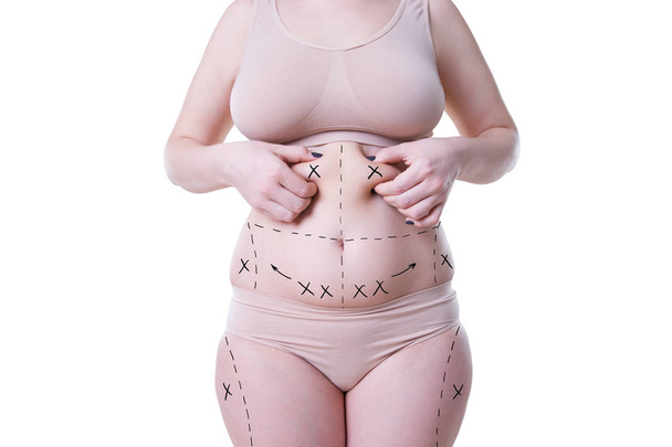 Concetto di rimozione di liposuzione, grasso e cellulite, corpo femminile sovrappeso con linee e frecce dipinte
 - Foto, immagini
