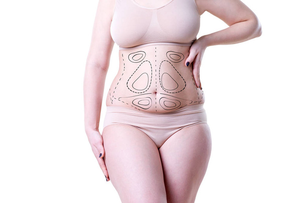 Conceito de lipoaspiração, remoção de gordura e celulite, corpo feminino com excesso de peso com linhas e setas pintadas
 - Foto, Imagem
