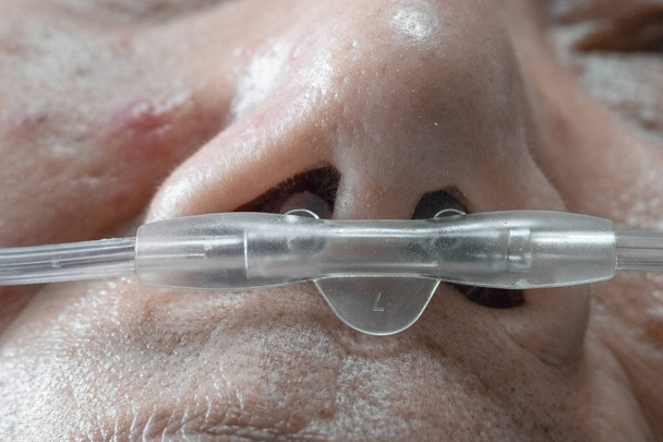 Mujer anciana con tubo respiratorio nasal para ayudar con su respiración
 - Foto, imagen