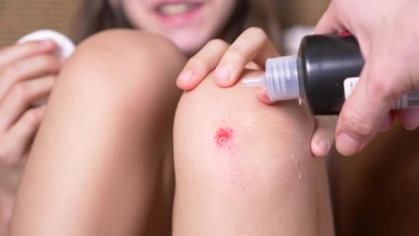 女の子膝に擦り傷を負った子供のけが人の膝。クローズ アップ。耐摩耗性に過酸化水素を注ぐ。4 k. スローモーション - 映像、動画