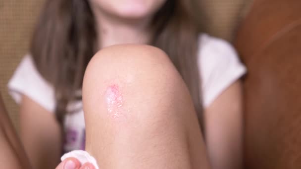 Wounded knee van het kind, schaafwonden op de schoot van de meisjes. Close-up. Giet waterstofperoxide op slijtage. 4 k. Slowmotion - Video