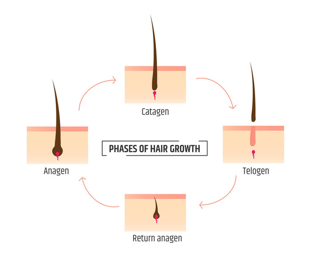 fases de crecimiento del cabello. Infografías tricología y dermatología. Depilación láser
 - Vector, imagen