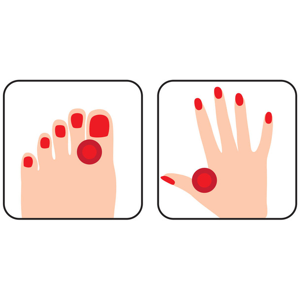 Painful and inflamed foot and hand, vector - Vector, Image