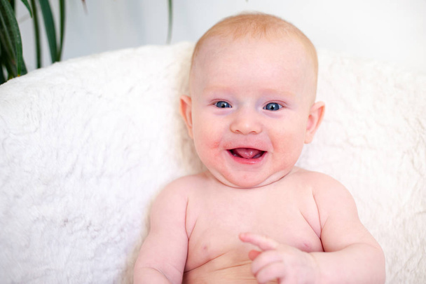Allergies, atopic dermatitis on the face of a baby - Фото, изображение