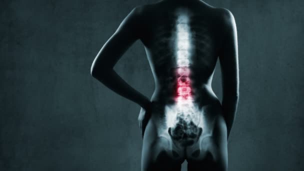Columna vertebral humana en rayos X
 - Metraje, vídeo