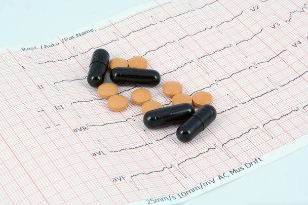 Orvosi tabletták EKG szalagon. Orvosi tabletták és a szívverés. - Fotó, kép
