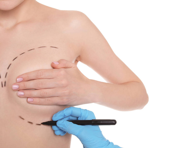 Doctor drawing marks on female breast for cosmetic surgery operation against white background, closeup - Фото, изображение