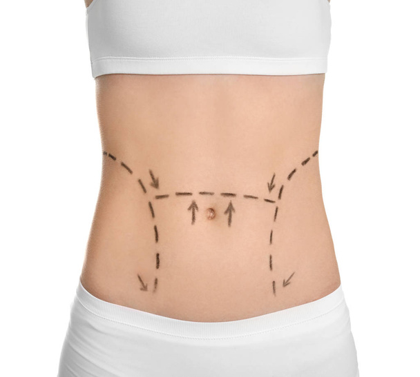 Young woman with marks on belly for cosmetic surgery operation against white background - Fotoğraf, Görsel