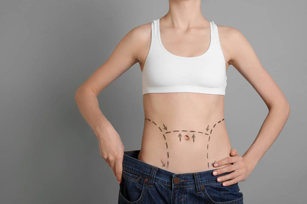Young woman with marks on belly in big jeans after cosmetic surgery operation against color background - Photo, Image