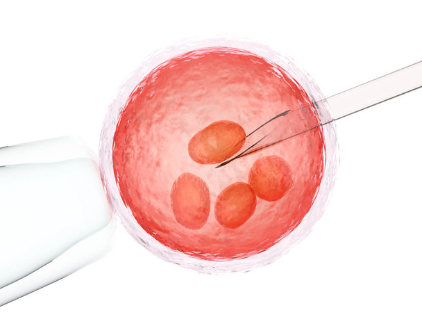 inseminación artificial o ivf
 - Foto, Imagen
