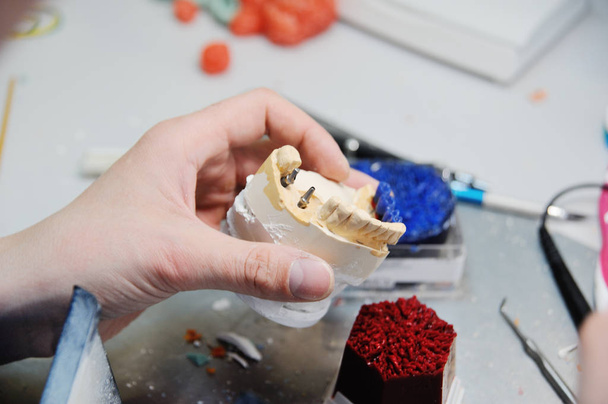 orthodontist makes a ceramic imprint of the jaw - Fotó, kép