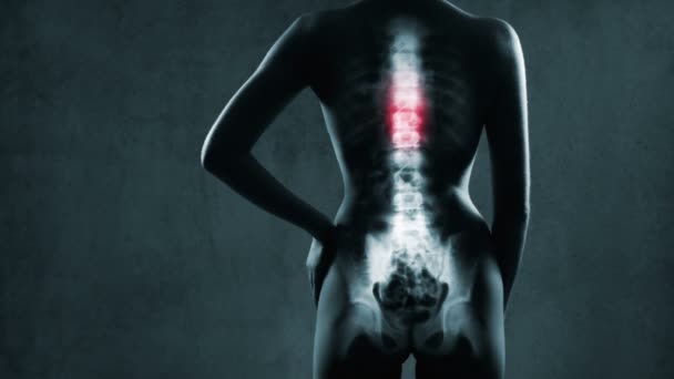 menschliches Rückgrat im Röntgenbild - Filmmaterial, Video