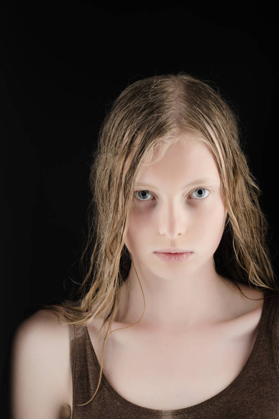 Albino woman with wet blond long hair, albinism. Albino girl with blue eyes and white skin. - Foto, Bild