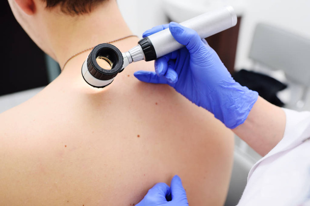 the doctor dermatologist examines birthmarks and birthmarks of the patient with a dermatoscope - Foto, Imagem