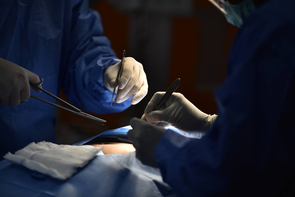 Team chirurg aan het werk in de operatiekamer. Chirurgisch licht in de operatiekamer. Voorbereiding voor het begin van chirurgische ingreep met een snede. De chirurg voert een operatie uit op de patiënt.. - Foto, afbeelding
