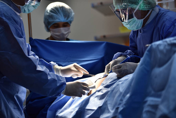 Χειρουργός ομάδας στο χειρουργείο. Χειρουργικό φως στο χειρουργείο. Προετοιμασία για την έναρξη χειρουργικής επέμβασης με κόψιμο. Ο χειρουργός χειρουργεί τον ασθενή.. - Φωτογραφία, εικόνα