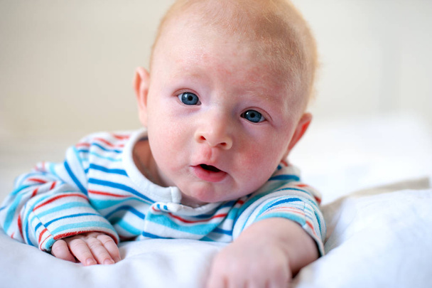 Allergies, atopic dermatitis on the face of a baby - Fotó, kép