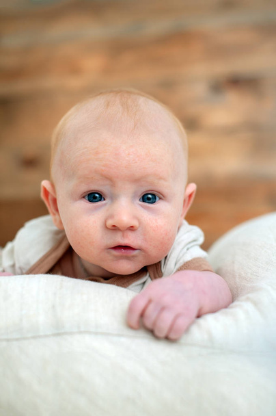 Allergies, atopic dermatitis on the face of a baby - Photo, Image