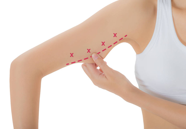woman grabbing skin on her upper arm with the red color crosses marking, Lose weight and liposuction cellulite removal concept, Isolated on white background. - Foto, Imagen
